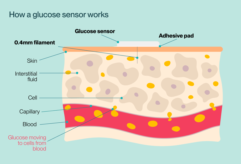 How CGM works