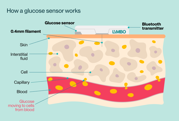 How CGM works